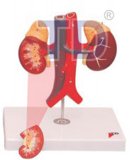 kidney with vessels