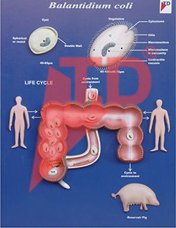 balantidium-coli
